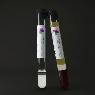 MANSON platelet rich plasma separation vacuum vacutainer prp tube